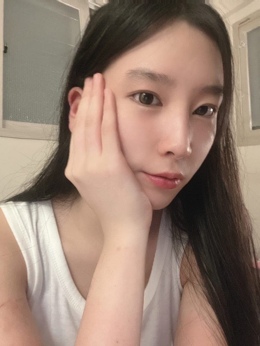 Bridge raised with own cartilage