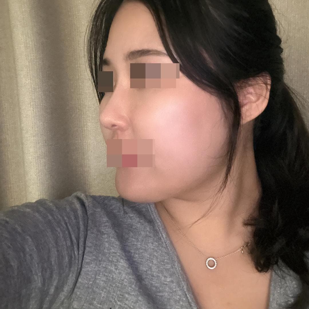 Reshaping the profile line
