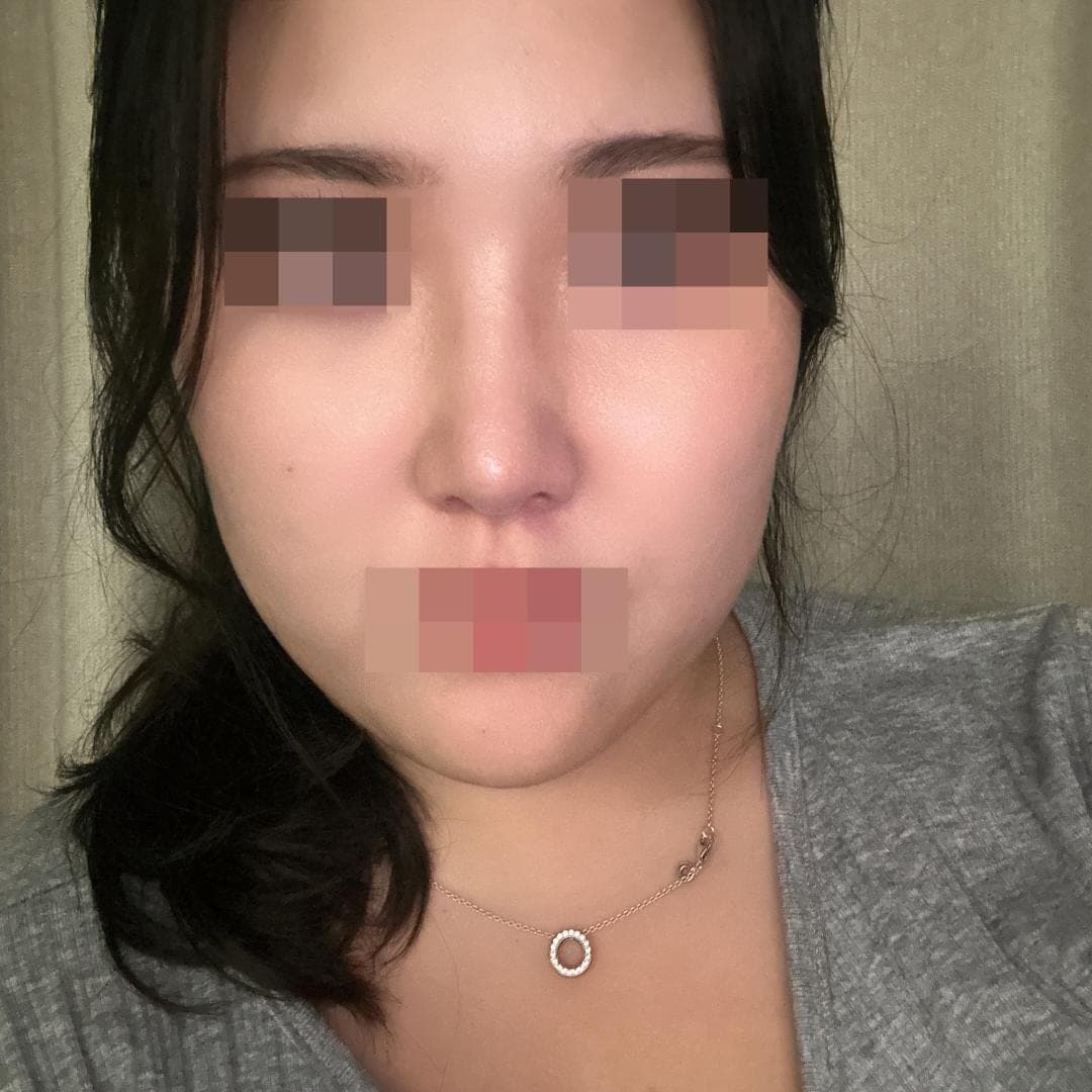 Reshaping the profile line