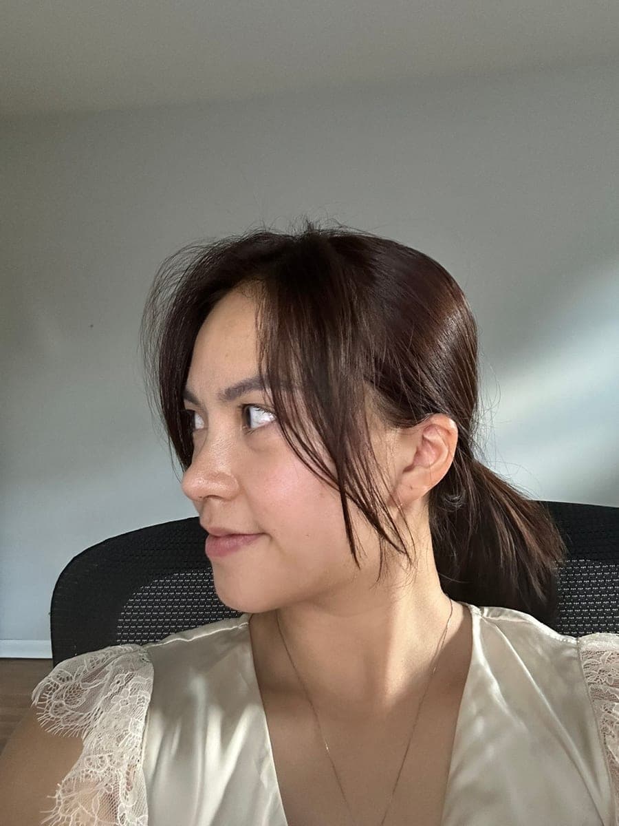 Bridge raised with own cartilage