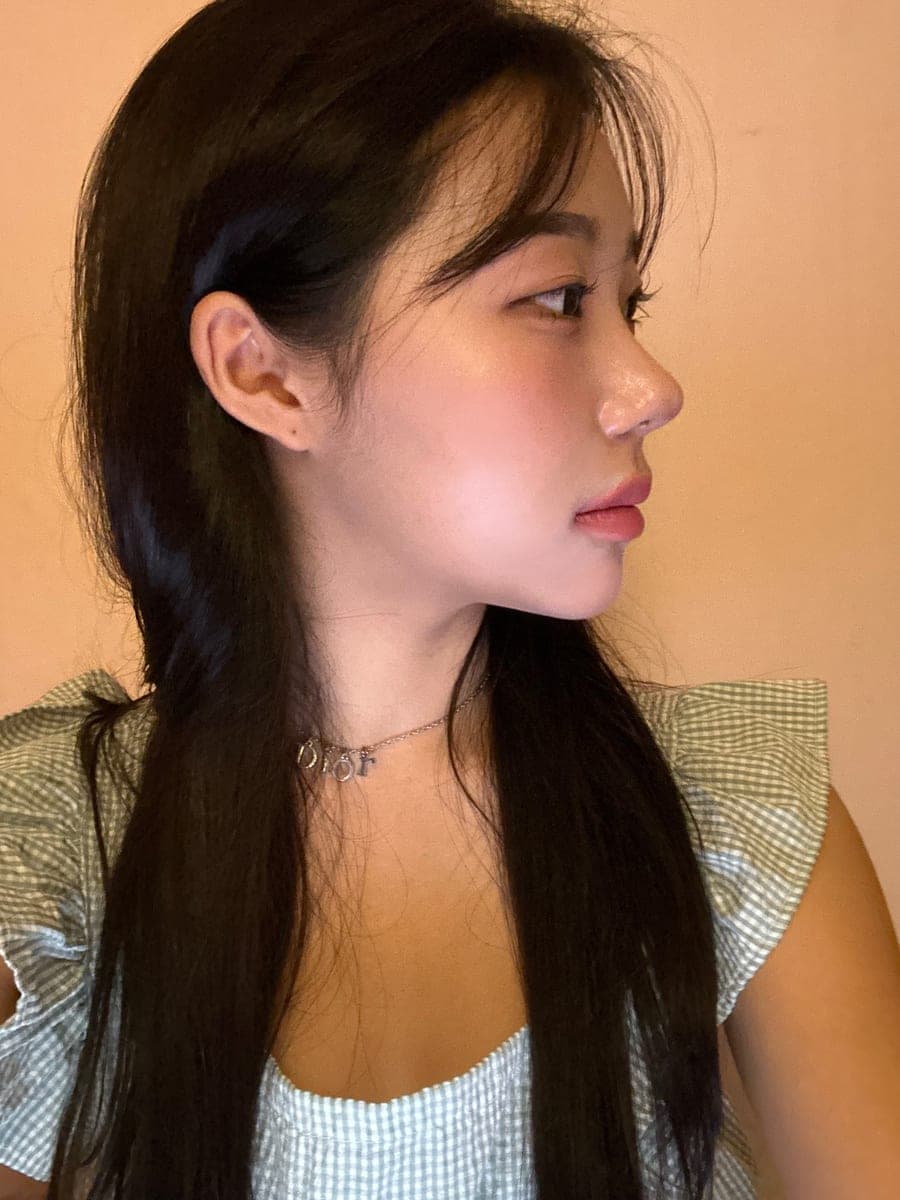 Tip only, with own cartilage