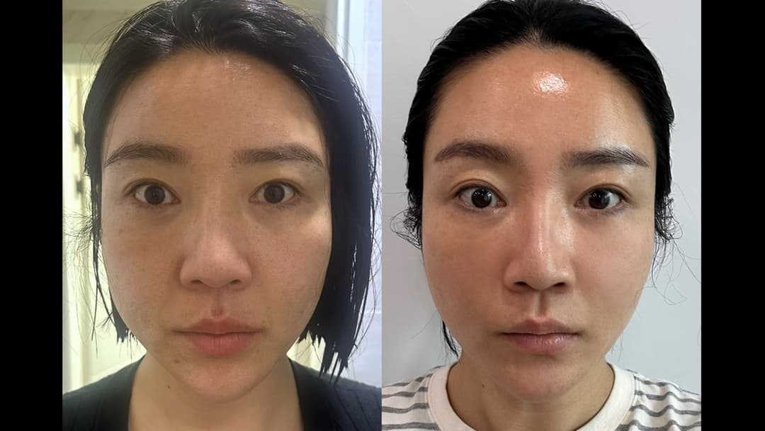 Olidia — Before and after